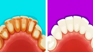 8 Эффективных и Натуральных Способов Избавиться от Зубного Налета