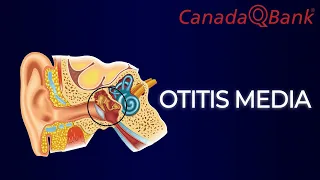 Otitis Media