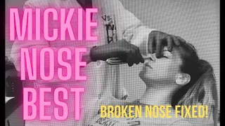 MICKIE NOSE BEST - Mickie James gets her broken nose fixed! Hilarious reactions!