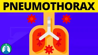 Signs of a Pneumothorax? (TMC Practice Question) | Respiratory Therapy Zone