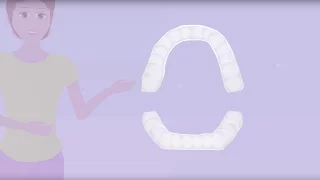 Invisalign Braces Animated Video/Trailer