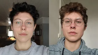 1  YEAR ON TESTOSTERONE update - TMI | FTM Trans Guy