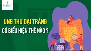 Ung thư đại tràng biểu hiện như thế nào?