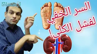 كيف تحمي الكليتين من أضرار المشي حافيا على السيراميك | هدم الأساطير | الاستشاري