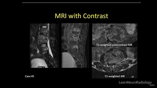 Neuroradiology spine lesions - Case 1 - overview - Choose your own adventure