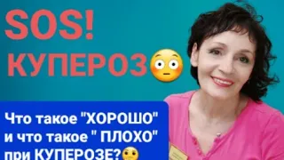 SOS! КУПЕРОЗ. Что такое " хорошо" и что такое "плохо" при КУПЕРОЗЕ?