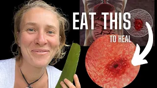 Eat These 4 Foods And Heal Your Stomach ULCER Fast