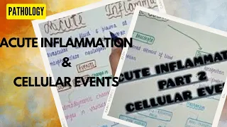 Acute Inflammation - Part 2 || Cellular Event