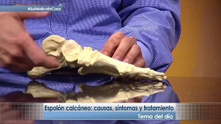 Espolón calcáneo: causas, síntomas y tratamiento | Su Médico en Casa