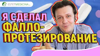 ФАЛЛОПРОТЕЗИРОВАНИЕ: отзыв после 🔥  Penile implant 18+ Трехкомпонентный гидравлический фаллопротез 🔥