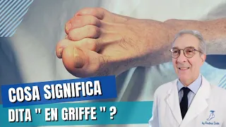 Cosa significa dita "en griffe" ?  | Dott. Andrea Scala