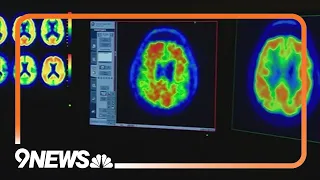 2023 brought new research, breakthrough treatments for Alzheimer's disease