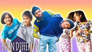 The Life Of Conjoined Twins | BORN DIFFERENT