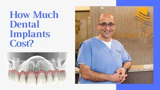 How much dental implants cost?