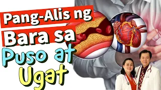 Pang-Alis ng Bara sa Puso at Ugat : Natural na Paraan - Payo ni Doc Willie Ong