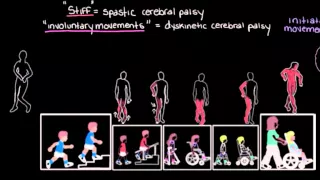 Khan Academy - Types of Cerebral Palsy Part 2: Dyskinetic & Ataxic