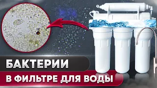 Фильтр для воды под микроскопом