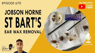 670 - Jobson Horne & Ear Hook Ear Wax Removal