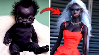 Unusual People Born with The Rarest Skin Color