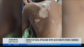 Family of Detroit girl attacked with acid wants more charges