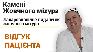 Камни в желчном пузыре операция (лапароскопия) - отзыв пациента клиники"Добрый прогноз"