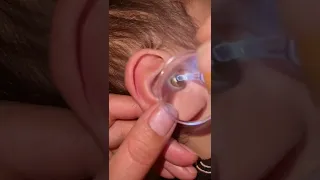 The best way to clean your child's ears