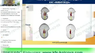 Каплина А В  2018 04 05 «Диагностика состояния здоровья «вслепую»Ч 1,2»