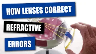 How Opticians Use Lenses To Correct Refractive Errors