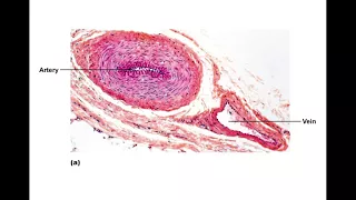 Chapter 19 Blood Vessels Part1