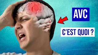 AVC (Accident Vasculaire Cérébral) : Causes, Symptômes et Traitements