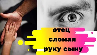 Отец сломал руку сыну.