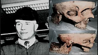 Yaptıklarıyla Kan Donduran Mezarlık Hırsızı:Ed Gein !