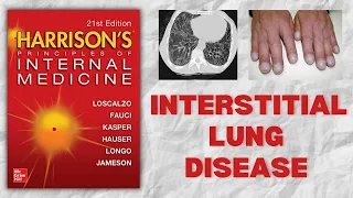 Interstitial Lung Disease | Classification | Pathogenesis | Approach | ILD | Harrison
