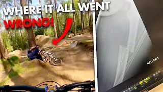 MY WORST CRASH EVER | SNAPPING MY FEMUR