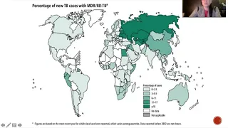 Lindsay Frank Seminar MDR TB