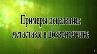 Метастазы в позвоночнике  Примеры исцеления Н  Пейчев, Академия Целителей