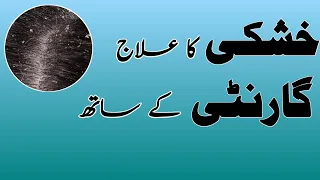 how to control dandruff and hair fall | khushki khatam karne ka tarika in pushtu  بالوں کی خشکی