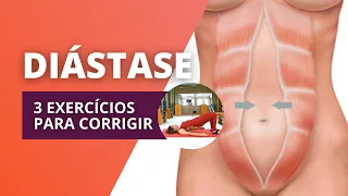 COMO CORRIGIR A DIÁSTASE com 3 EXERCÍCIOS em casa | Método Pilates