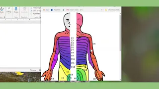 Spinal Cord Injury and Guillain-Barre