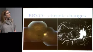 Retinal Vascular Disease