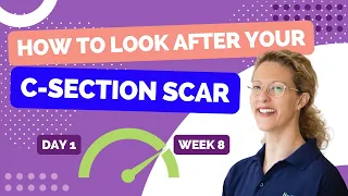 HLP Therapy - How to Look After Your C-section Scar From Day 1... to Week 8