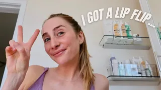 Day in My Life Vlog + Getting a Lip Flip! (Botox)