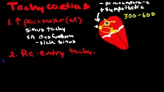 Pathophysiology of Cardiac Arrhythmias