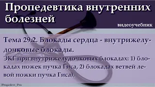 Тема 29.2. Блокады сердца – внутрижелудочковые блокады.