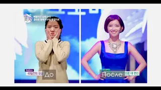 Plastic Surgery Clinic in Korea - VIEW Plastic Surgery  [English Sub]