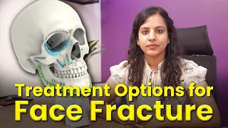 ✅Face Fracture Causes and Treatment | ✅Face Fracture Healing, Post Surgery Care and ✅Common Areas