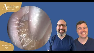 EAR WAX PEEL COMPILATION: 3 PATIENTS EARS- EP 799