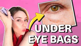 How To Get Rid Of Under Eye Bags & Puffy Eyes! | Dr. Shereene Idriss