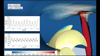 Cavitation Noise Source