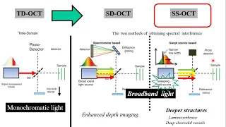 2021 OCT  in Glaucoma (1) : OCT physics